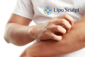 Best Actinic Keratoses Removal 4 prevent your actinic keratoses Thrapston getting worse - call our team today!