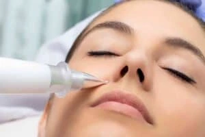 Best Actinic Keratoses Removal 3 Actinic keratoses Thrapston solutions - book in today!