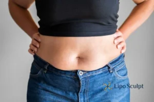 Bidding Farewell to Muffin Tops with Aqualyx Fat Injections 2 Do you wish you could reduce your muffin top Thrapston With Aqualy fat dissolving injections you can!